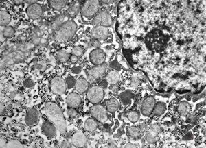 M,2y. | normal hepatocyte M,2y. | normal hepatocyte